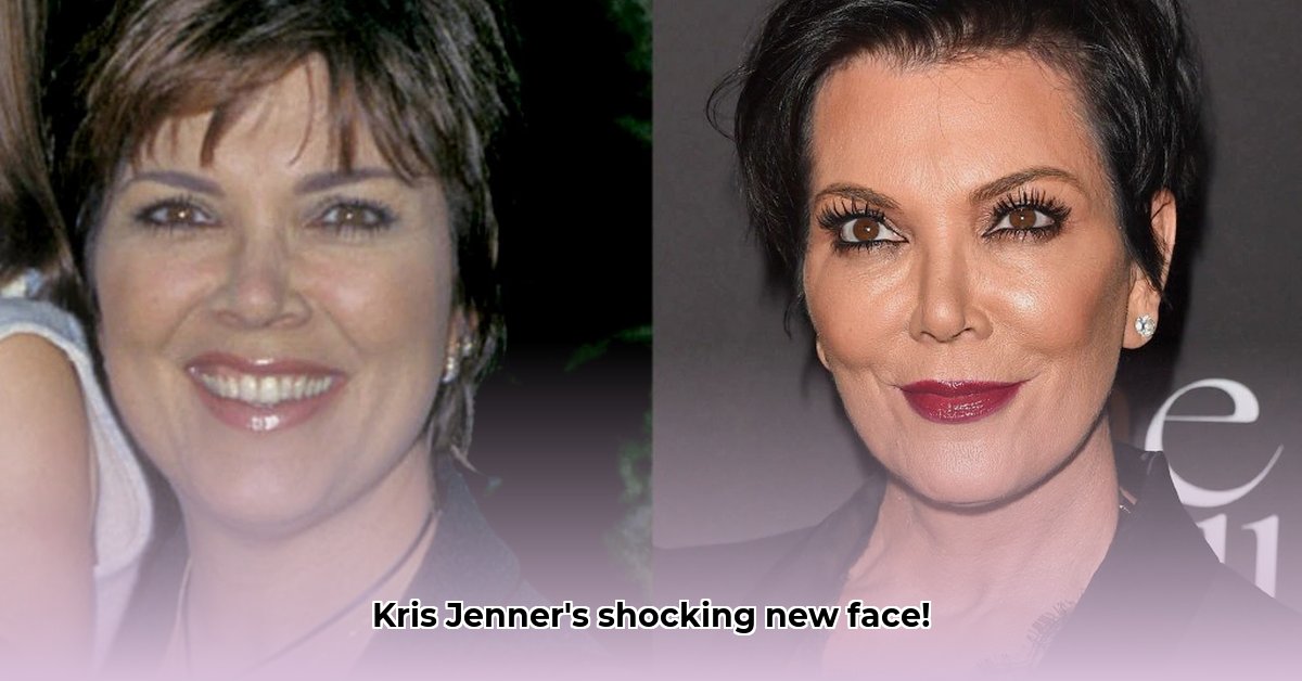 chris-jenner-new-face